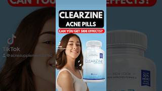 Clearzine Acne Pills acnes skincaretips [upl. by Nnaeirelav178]