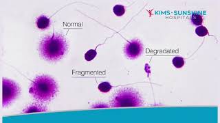 Male Factors for Recurrent Pregnancy Loss [upl. by Omsare959]