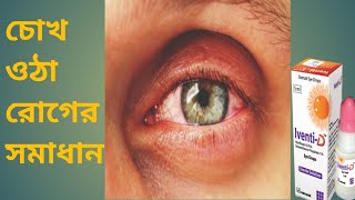 iventiD eye dropচোখ ওঠা রোগের সমাধান।BD health24 [upl. by Jonah]