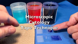 Microscopic Cytology Tape Technique [upl. by Royall]