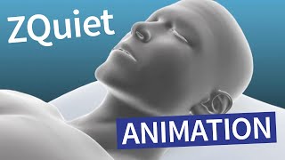 ZQuiet Orthèse antironflement – Animation [upl. by Eadith]