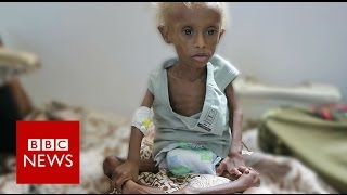 Yemen On the brink of starvation  BBC News [upl. by Oinotnanauj662]