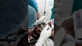 Intubation procedure doctor patient icu [upl. by Iblehs524]