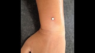 Micro Dermal Piercing Arm [upl. by Nosle]