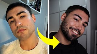 CÓMO HACER CRECER LA BARBA NATURAL Y RÁPIDO SIN MINOXIDIL [upl. by Trocki]