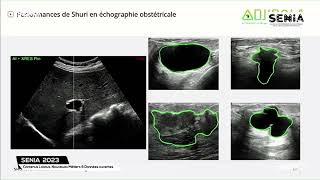 SENIA 2023 Démonstration de l’application Shuri  l’IA auxiliaire de santé en imagerie médicale [upl. by Diba437]