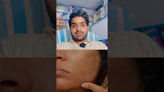 Meglow leeford fairness creams for men a small review in Hindi for hyperpigmentation for less minim [upl. by Gromme]