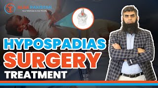 Treatment Strategy of Hypospadias Surgery in Boys  Hypospadias Boys  Alsa Pakistan [upl. by Lavery]