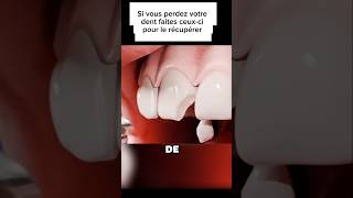 Processus de réparation dune dent shortvideo sciencepopulaire shorts dentist shortviral [upl. by Leinto]