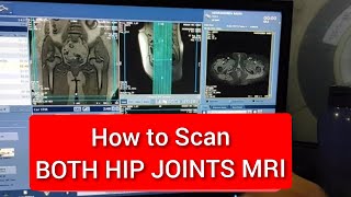 Hip Joints MRI Scan Protocol Positioning amp Planning  Live Demo on GE 15 Tesla [upl. by Waldner47]