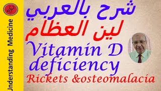 Vitamin D  deficiency Rickets and Osteomalacia شرح بالعربي نقص فيتامين د ولين العظام [upl. by Maddy]