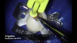 Manual Technique for Curved Root Canal Preparation [upl. by Arehahs455]