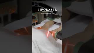 Lipolaser [upl. by France674]