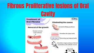 Lecture 5 Fibrous Proliferative lesions of Oral Cavity 🔥GI PathologyBest Medical Channel [upl. by Irihs77]