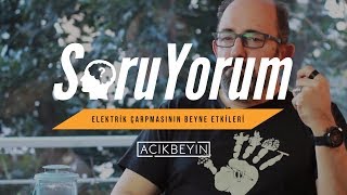 SoruYorum  Elektrik Çarpmasının Beyne Etkileri [upl. by Gregoor]