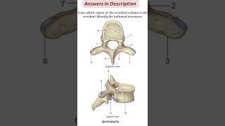 identify the parts of vertebrae humananatomy [upl. by Lezah]