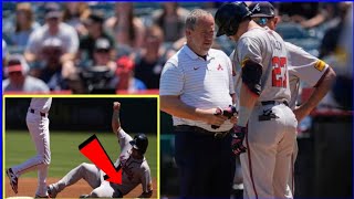 Austin Riley injury 🔴 Braves Austin Riley Out for Extended Time with Fractured Hand 🖐️ [upl. by Raseac113]