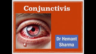 EOV amp TCM concept for conjunctivitis Quiz given below to test your knowledge as per this video [upl. by Willabella]