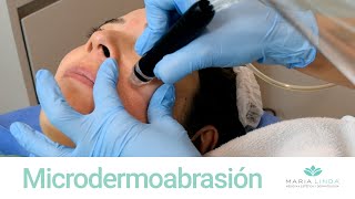 TRATAMIENTO FACIAL  Microdermoabrasión  María Linda [upl. by Irvin]