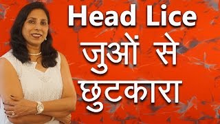 जुओं से छुटकारा कैसे पाएं  How to remove Head Lice with Home Remedies  Ms Pinky Madaan [upl. by Cissie]