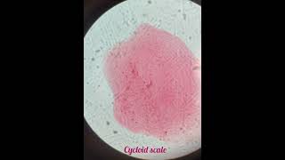 Scales Of Fish  Placoid Scale  Ctenoid Scale Cycloid Scale🐠🐋🐟 [upl. by Edbert]