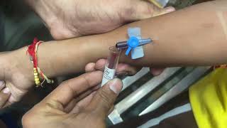 Intravenous Cannulation  iv cannula fixing  blood collection using by cannula  iv vigo [upl. by Lorrad]