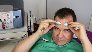 Äderchen im Gesicht  Dr Günther lasert sich selbst  Video Erfahrungsbericht Laserbehandlung [upl. by Oecam]