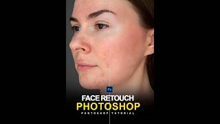 The Realistic Way Make a Skin Retouch in Photoshop  Photoshop shorts Tutorial [upl. by Phippen714]