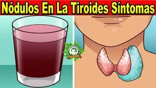 Nódulos En La Tiroides Síntomas y Tratamiento Natural Prueba Este Jugo y Bébelo De Esta Forma [upl. by Neve]