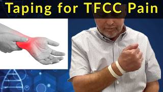 How to Tape your Wrist for Ulnocarpal Pain and TFCC Injuries [upl. by Nevla101]