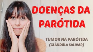 Doenças da parótida glândula salivar [upl. by Rodman]