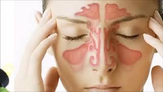 How to Use Wild Oregano Oil to Treat Sinusitis  Herbal Treatment for Sinusitis [upl. by Barbi]