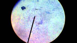 STAPHYLOCOCCUS EPIDERMIDIS SIMPLE STAINED [upl. by Nolla]