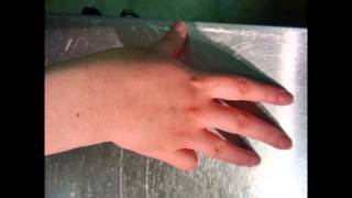 Lateralization Practice  Southlake Hand Therapy [upl. by Oileduab]