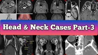 Radiology Viva Cases  386392  Head and Neck Exam Cases Part 3 medical radiology [upl. by Ednalrim]