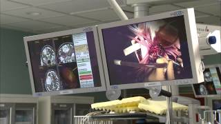 Awake Craniotomy at BarnesJewish Hospital [upl. by Ramad]