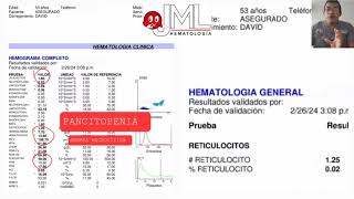 HEMÓLISIS INTRAMEDULAR EN ANEMIA MEGALOBLÁSTICA [upl. by Newcomb]