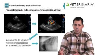 Endocarditis valvular [upl. by Yentiw997]