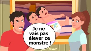 La mère a forcé les médecins à séparer les jumeaux siamois et ce fut notre tragédie [upl. by Aihsela137]