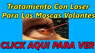 Tratamiento con Laser Para Las Moscas Volantes  Que es La Vitreolisis [upl. by Kurtis]