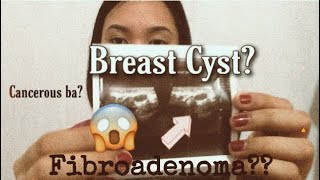 Breast Cyst Story  Fibroadenoma  Mammotome Biopsy Operation  Tagalog [upl. by Machute9]