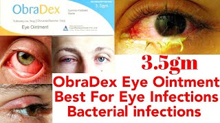 Obradex Eye ointment  ObraDex Eye Ointment uses in Urdu Hindi [upl. by Ivets]