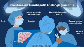 Percutaneous transhepatic cholangiography PTC [upl. by Aissatan]