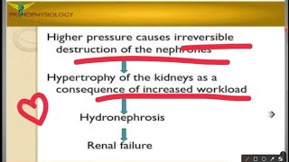 Hydronephrosis [upl. by Noneek]