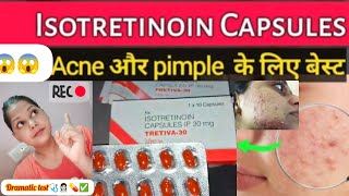 1 Medicine For Curing Pimples FAST✅My Experience With Doxycycline For Acne 😱🤯isotretinoin skincare [upl. by Atneciv376]