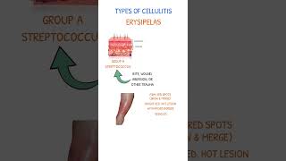 CELLULITIS ERYSIPELAS [upl. by Nerfe266]