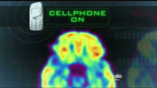 Cell Phones Mysterious Effects on the Brain 2222011 [upl. by Annawek]