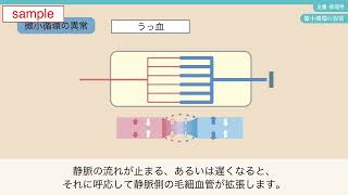 メヂカルフレンド社「新体系看護学全書 病理学」サンプル動画② 微小循環の異常 [upl. by Ariada]