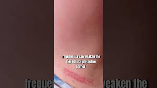 Watch This Before Using Hair Removal Creams ⚠️Dermatology Tips [upl. by Atwekk]