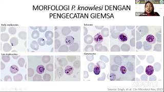 Plasmodium Knowlesi  Webinar ITKES WHS [upl. by Arual]